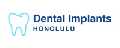 Dental Implants Honolulu