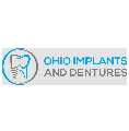 Ohio Implants and Dentures