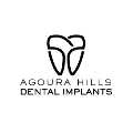 Agoura Hills Dental Implants