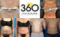 360 Plastic Surgery